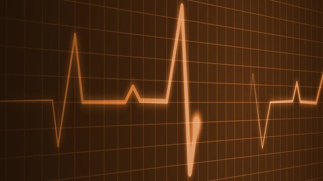Irregular heartbeat line flat start and end, showing a medical ecg pattern and heart rhythm problem animation