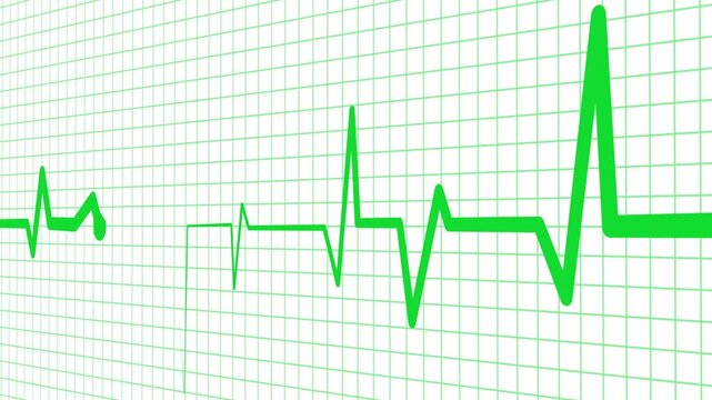 Heartbeat line irregular electrocardiogram pattern animation