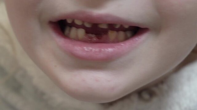 Child pointing finger at missing milk tooth in open mouth close up, Close-up of a child's open mouth with a missing front tooth
