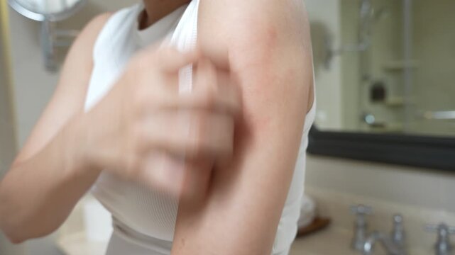skin problem and beauty. Young woman scratch body has itchy skin from skin allergic, steroid allergy, sensitive skin, red from sunburn, chemical allergy, rash, insect bites, Seborrheic Dermatitis.