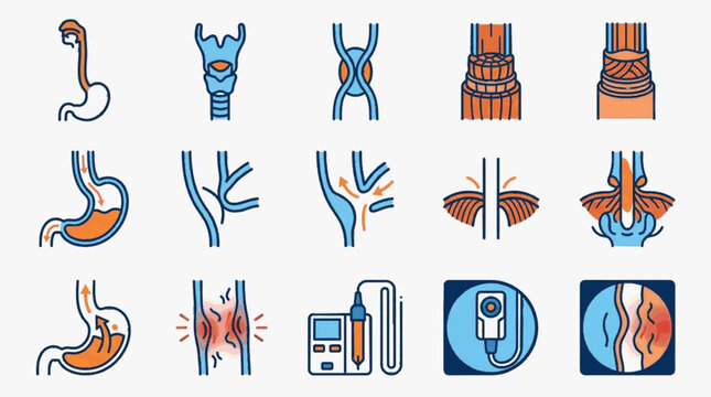 Vector icon set of human digestive system including esophagus, stomach anatomy, acid reflux symptoms, gastroesophageal reflux disease GERD, endoscopy, hiatal hernia, and medical tools.