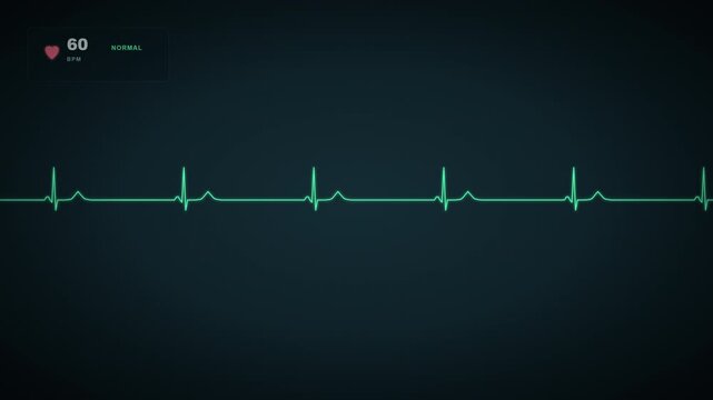Green heart rate monitor displaying normal heartbeat on a dark screen with 60 bpm pulse line