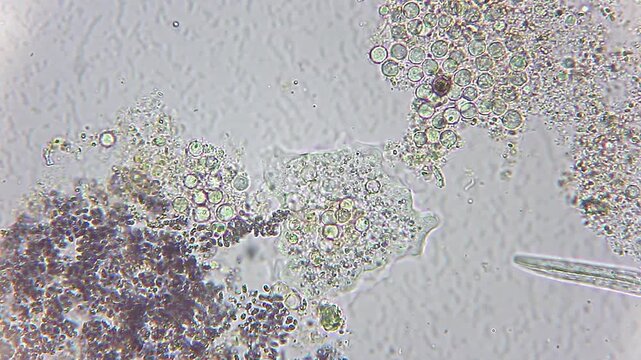 Microscopic amoeba extending pseudopodia and changing shape under 400x brightfield microscopy 4K