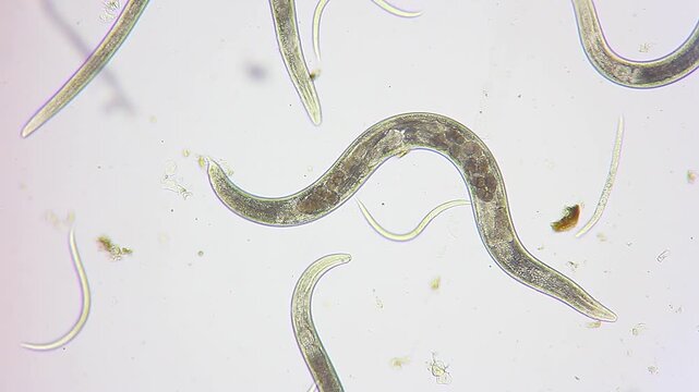Gravid female nematode roundworm with distinct internal eggs under 100x brightfield microscopy 4K