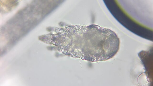 Microscopic dust mite with changing focus showing detailed body anatomy under 400x brightfield microscopy 4K