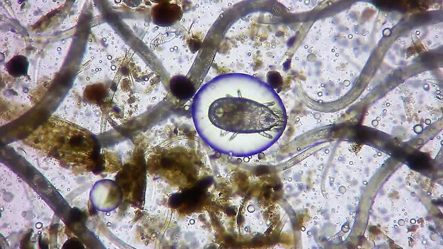 Microscopic dust mite trapped in an oil bubble surrounded by active nematode roundworms under 100x brightfield microscopy 4K