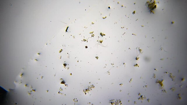 Small nematode roundworm moving through scattered detritus under 40x brightfield microscopy 4K