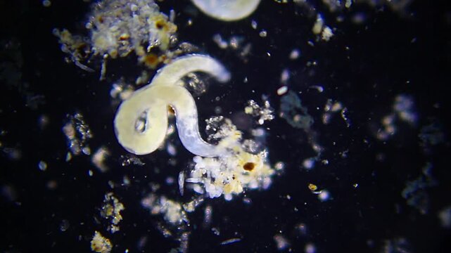 Two segmented annelid worms crawling through organic detritus under 40x darkfield microscopy 4K
