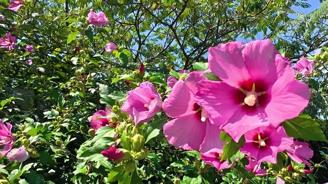 Vibrant pink hibiscus flowers swaying gently among green leaves in bright sunlight, with blue sky and branching trees in a lush outdoor garden