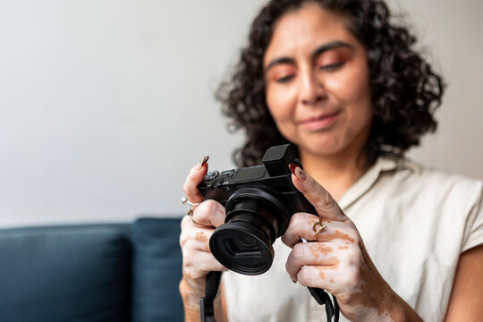 Woman with vitiligo review camera photos at home