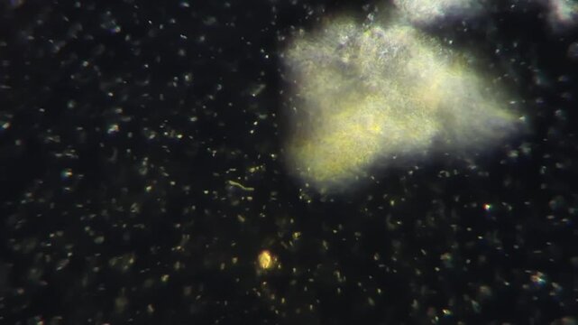 Darkfield Microscopy of Active Household Bacteria and Microorganisms at 600x Magnification