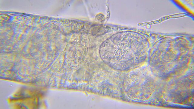 Microscopic view of developing embryos inside eggs within a gravid nematode under 400x brightfield microscopy 4K