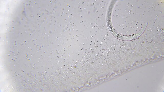 Microscopic nematode roundworm swimming through dense bacteria population under 400x brightfield microscopy 4K