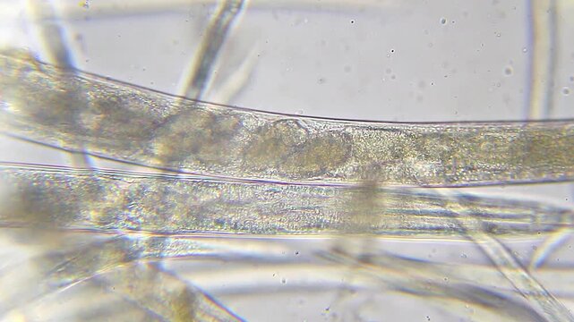 Developing embryos and egg cells inside a transparent gravid nematode under 400x brightfield microscopy 4K
