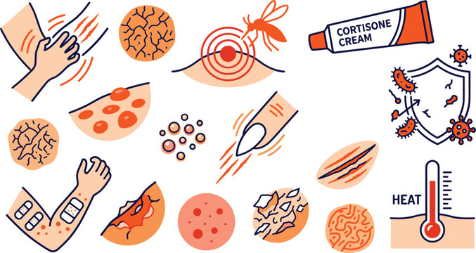 Skin allergy and eczema symptoms icon set featuring dermatitis inflammation scratching treatment cortisone cream medical vector illustrations