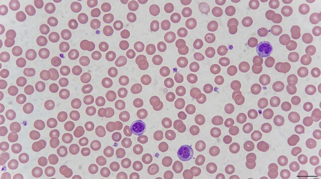Microscopic view of human blood cells including red blood cells white blood cells and platelets