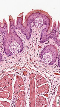 Microscopic view of taste buds on a tongue papilla with muscle tissue below