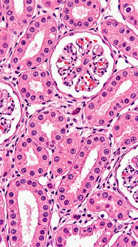 Microscopic view of kidney glomerulus and tubules histology science medical anatomical detail