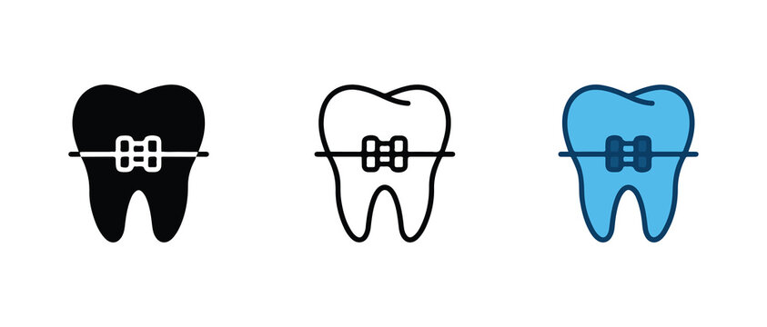 teeth with braces in different styles and colors for medical or dental design projects