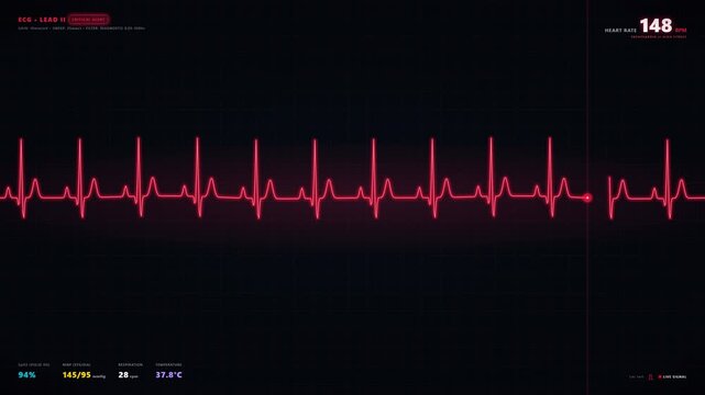 Close up of a heart rate monitor displaying a healthy EKG reading.