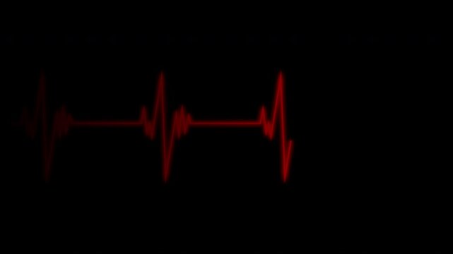 Cardiograph recording pulse featuring heartbeat flatline on black background. 4k animation