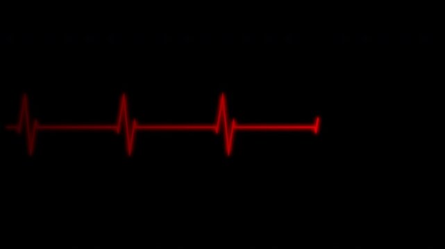 Cardiograph recording pulse featuring heartbeat flatline on black background. 4k animation