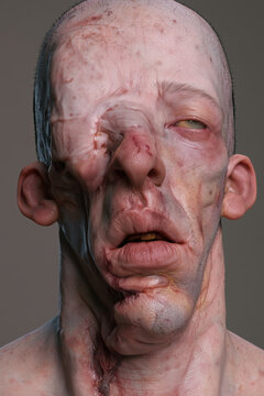horror portrait mutant, pale scarred man with collapsed nose and swollen parted lips, sparse hair, photorealistic