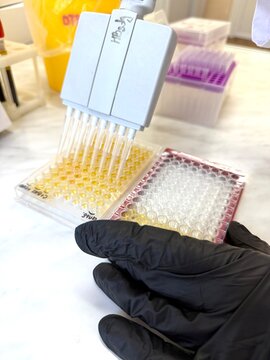 Scientist performing ELISA test with multichannel pipette in lab