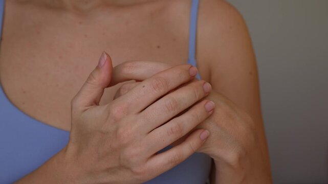 Young woman applies cream to inflamed skin on the knuckles and back of her hand, treating redness, irritation, allergy symptoms, and dermatitis flare-up