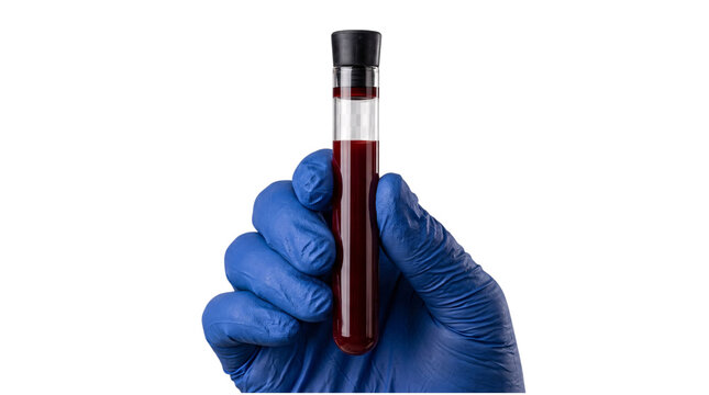 Hand in blue glove holding sample test tube isolated on transparent background