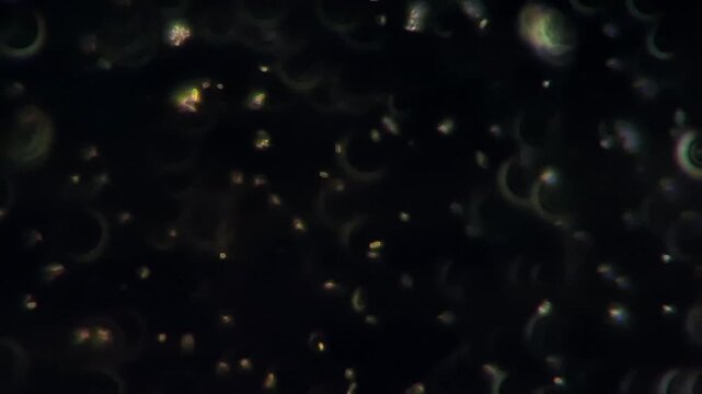 Gut microbiota probiotics under darkfield microscope - Lactic acid bacteria and yeast in fermented milk kefir 