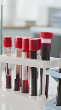 Vertical shot of test tubes with blood samples standing in rack during laboratory analysis. Footage fits medical research, healthcare diagnostics, clinical trials, hematology projects