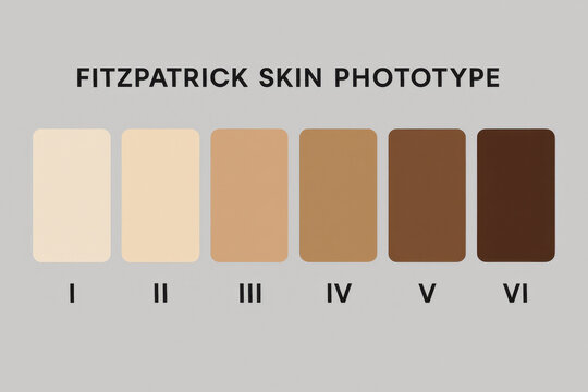 Fitzpatrick skin phototype classification chart with six color swatch arranged in row on neutral gray background for clinical dermatology reference