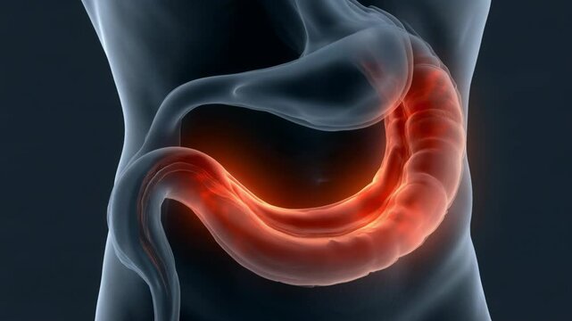 Understanding heartburn and its effects on the stomach due to high acidity and irritation