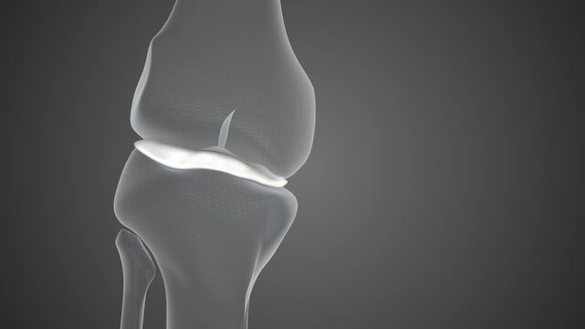 Meniscus Repair and Healthy Knee Function