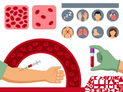 Anemia Infographic Set Showing Low Red Blood Cell Count Symptoms and Blood Test Procedure
