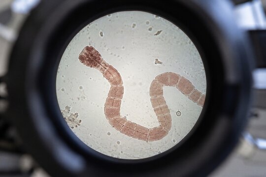 Microscopic view of a tapeworm parasite through a laboratory lens