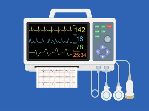 Professional Fetal Heart Rate Monitor Illustration with Digital ECG Display, Medical Equipment for Pregnancy and Obstetric Care
