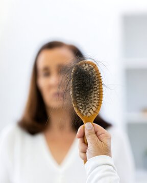 Woman holding a hairbrush covered with shed hair, excessive hair loss concept for rapid weight loss, GLP-1 side effects, nutrition deficiency and female hair health