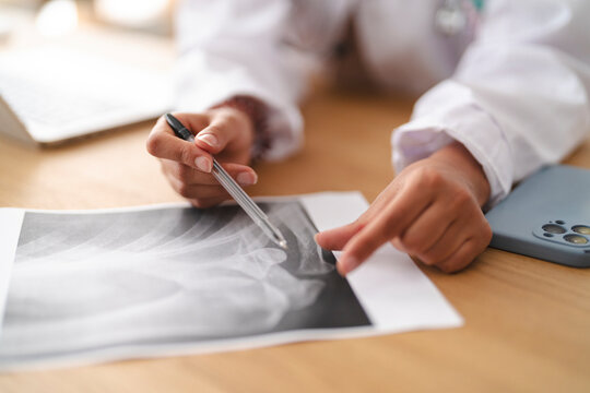A medical professional wearing a white coat sits at a wooden desk and carefully examines a patient x-ray scan, pointing to specific details with a pen in hand.