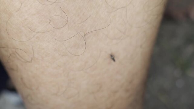 A mosquito resting and biting on human skin