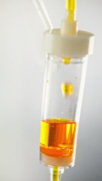 Medical staff closely monitor an advanced intravenous transfusion setup as a transparent tube steadily channels medicinal liquid into an infusion chamber during patient treatment and care