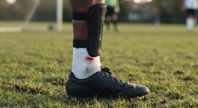 Close-up of soccer player leg with shin guard and minor scrape on the sock