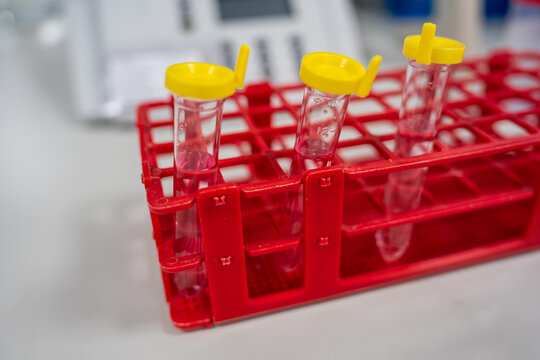 Test Tubes in a Red Rack on a Laboratory Table