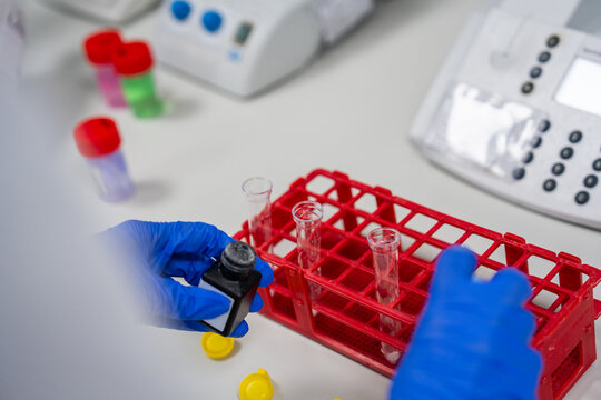 Scientist Works With Test Tubes in a Laboratory Setting