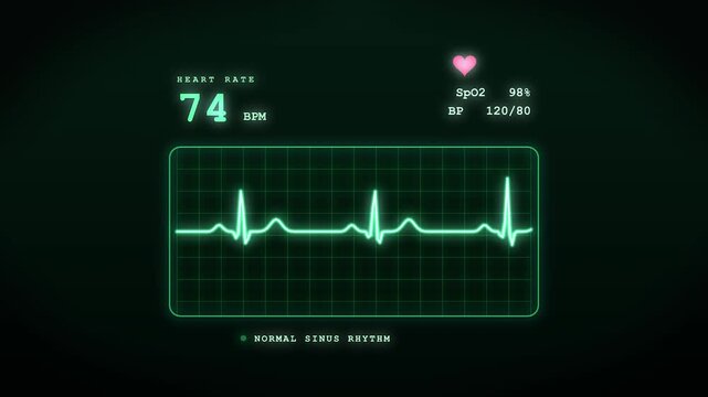 Heart rate monitor displaying normal sinus rhythm on medical interface with glowing green electrocardiogram line