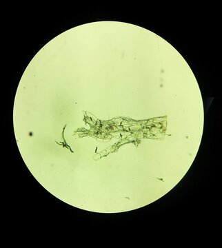 Microscopic view of Drechslera teres (Pyrenophora teres) multicellular conidia, causal agent of net blotch disease on barley crops, light microscopy