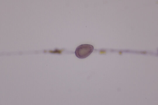 View in microscopic of Opisthorchis viverrini egg from human bile medical background concept. Egg parasite in stool exam real sample from patient liver cancer.