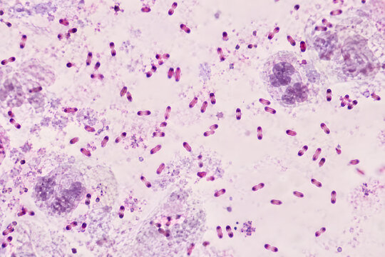 Bipolar stained bacteria in a conceptual microscopy illustration