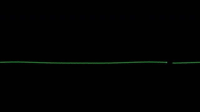 Asystole flatline ECG on a patient monitor no heartbeat loop
